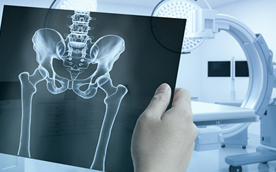 X-Ray Examination